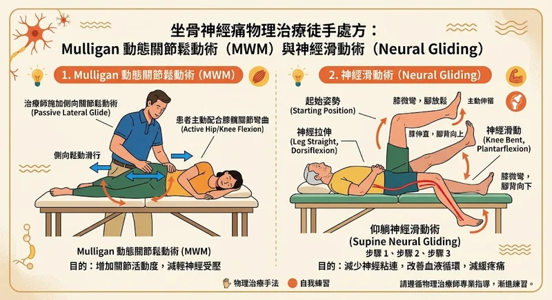 坐骨神經痛徒手處方 Mulligan MWM 與神經鬆動術圖